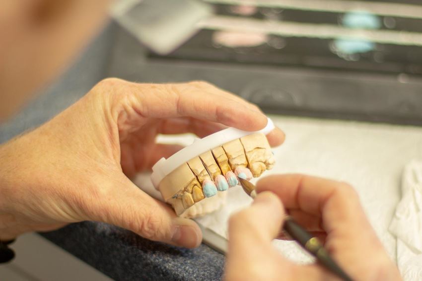 Cechy implantów